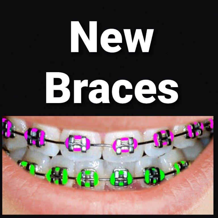 new braces