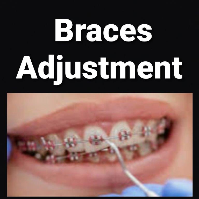 adjust braces